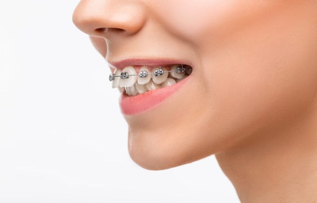 Smile Harmony: Navigating the World of Orthodontics